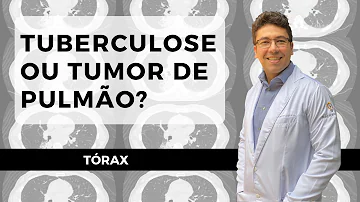 Como fica o pulmão com tuberculose?