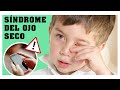 ♦️ Por qué mi niño tiene ARDOR y PICAZÓN en los ojos? 👀 Síndrome del OJO SECO