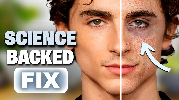 Fix Your Eye Bags & Dark Circles Forever! (Using Science)