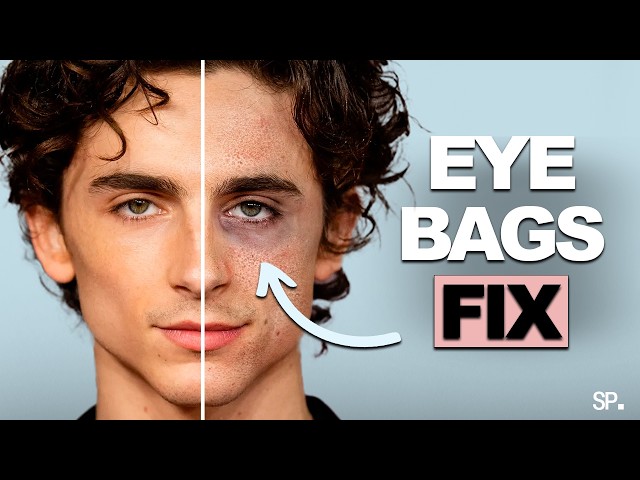 EVERY METHOD To Get Rid Of EYE BAGS & DARK CIRCLES (Science Based)