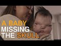 'A BABY MISSING THE SKULL’ （supported by Nishitan clinic） #Nishitanclinic#JapanBarrierFreeProject