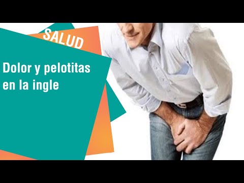 ¡Descubra por qué aparecen esas pelotitas en la ingle!