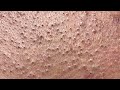 Satisfying Hien Spa Beauty Relaxing Video #27