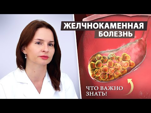 Желчнокаменная болезнь: как предотвратить осложнения и сохранить здоровье