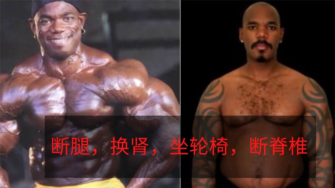 健美史上7位王者退役後的前後對比！有的断腿，换肾，坐轮椅，断脊椎