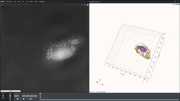 Human monocytes derived macrophages