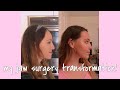 my journey with upper jaw surgery| after surgery, weekly updates & pictures