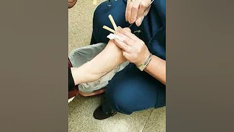 No more ingrown toenails!!