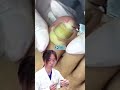 爪囲炎の治療動画を見て、丁寧な仕事ぶりにたかし先生が関心！