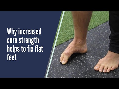 How to fix your Flat Feet through Core Strength