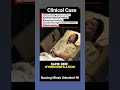 Medical Quizzes #medical #medicine #neurology #medicalstudent #medicaleducation #nursingstudent #gnm