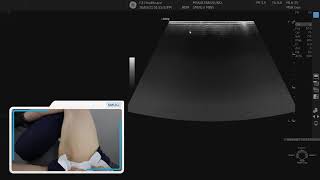 Adductor Muscle -  2 min series MSKUS