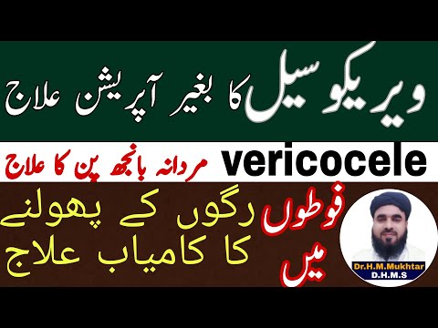 Varicocele Ka Ilaj Varicocele Treatment At Home In Urdu Hindi व र क स ल ठ क कर ब न सर जर क
