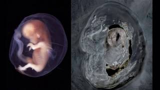 Libyadaki İnsan Embriyosu Şekli Waw An Namus Google Earth