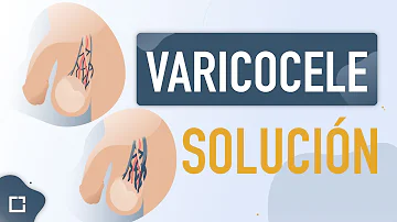 O que piora a varicocele?