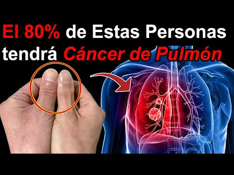 Es el <strong>Signo</strong> que Alerta que Tus PULMONES están ENFERMO