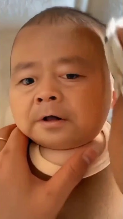 Bayi viral berwajah tua #viral