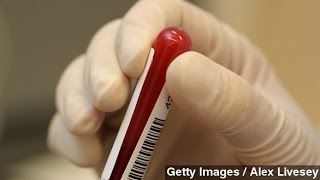 Can A Blood Test Predict Psychosis Risk?