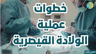 كيفية إجراء عملية الولادة القيصرية خطوة بخطوة بدقّة عالية || Caesarean delivery