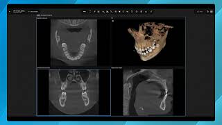 DS Core Diagnose Features - Full-Screen Mode and MPR Layout for 3D X-rays