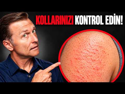Kuru Gözler, Kuru Ağız ve İnişli çıkışlı Kolların Arkasındaki Tek Eksiklik