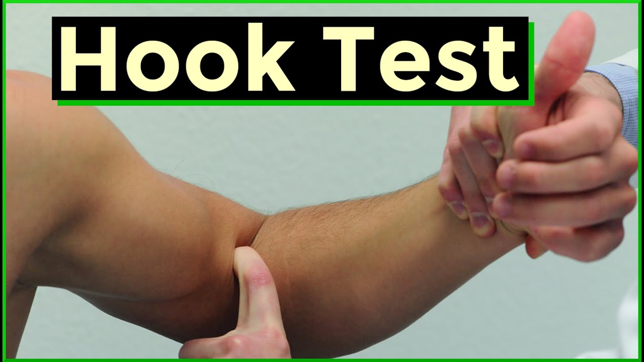 Тест с крючком | Разрыв дистального сухожилия двуглавой мышцы плеча