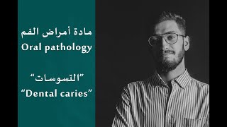 مادة أمراض الفم (2) | Oral Pathology LEC.(2)