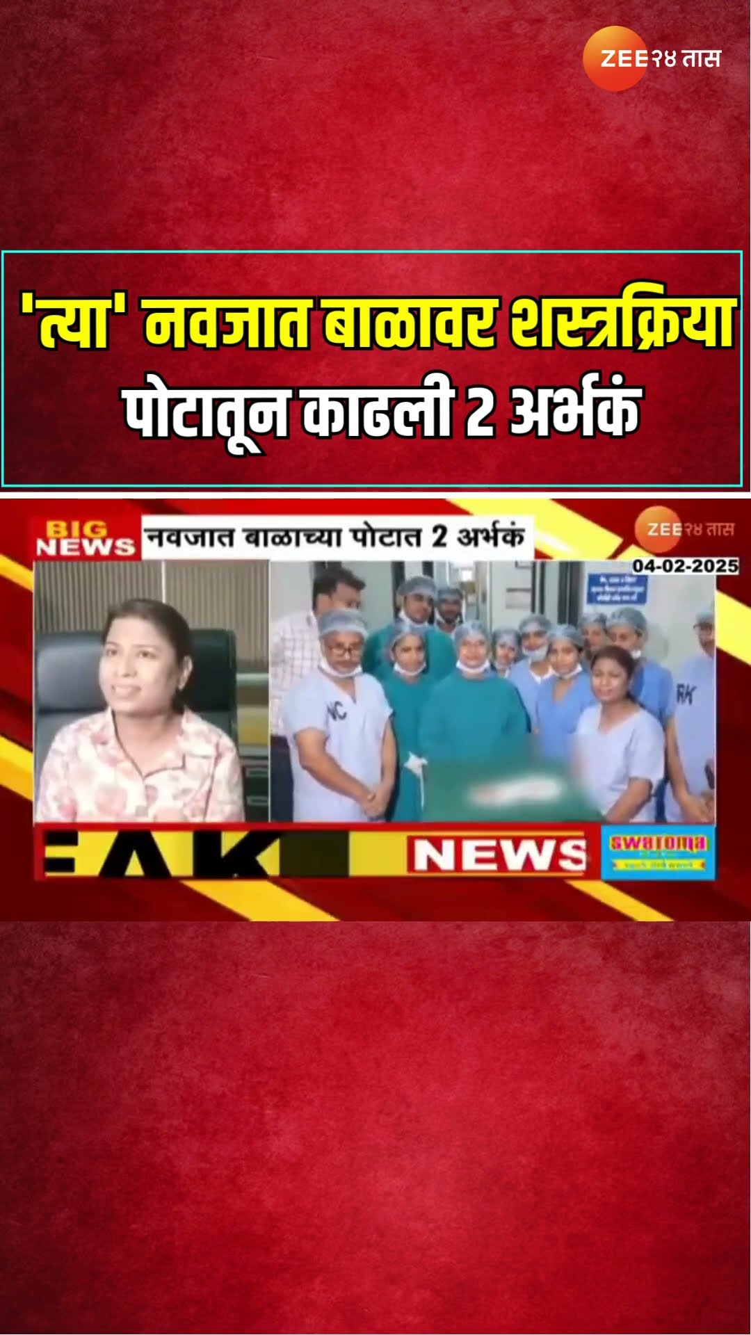 Amravati | 'त्या' नवजात बाळावर शस्त्रक्रिया ; डॉक्टरांनी बाळाच्या पोटातून काढली 2 अर्भकं