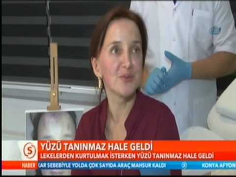 SAMANYOLU HABER - Sahte Doktor Kurbanı Kadının Yüzünde Şaşırtan Değişim