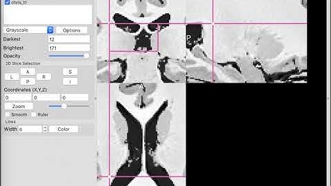 MRIcroGL Introduction