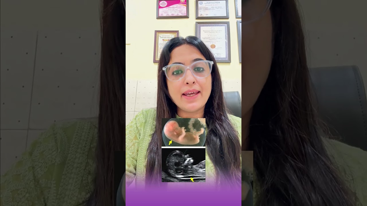 Importance Of NT Scan In Pregnancy 