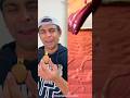 Akhrot Ne Dant Tod Diya 😂 | Funny Comedy Shorts 2026#funnyshorts #comedyshorts #funnyvideo