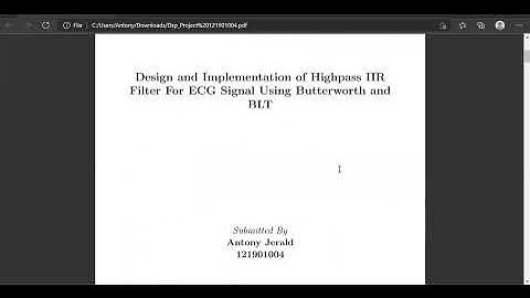 Design and Implementation of High pass IIR Filter For ECG Signal Using Butterworth and BLT