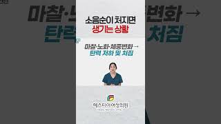 소음순이 처지면 생기는 상황