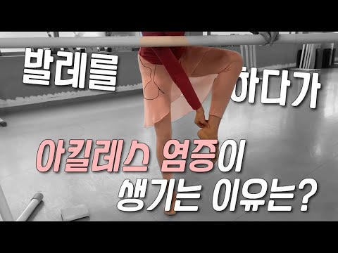 발레 팁 : 를르베 업을 서면 아킬레스가 아파요 / 포인을 할때 아킬레스에서 우두둑 소리가 난다??!