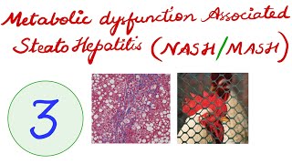Metabolic dysfunction - Associated Steatohepatitis (MASH/NASH) – PART 3 (Morphology)