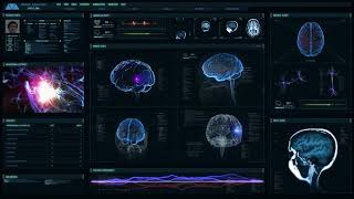 MRI Imaging - TBI Analytics