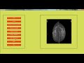 Digital Image Processing Projects & Thesis List ๐ธ