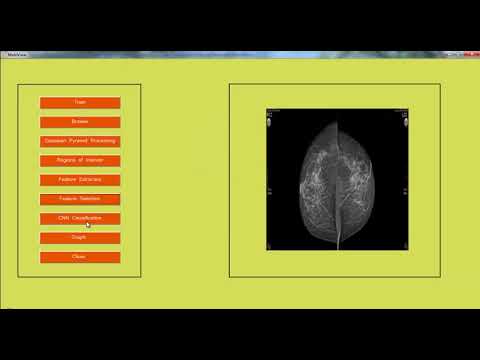 Digital Image Processing Projects List | Digital Image Processing Thesis List