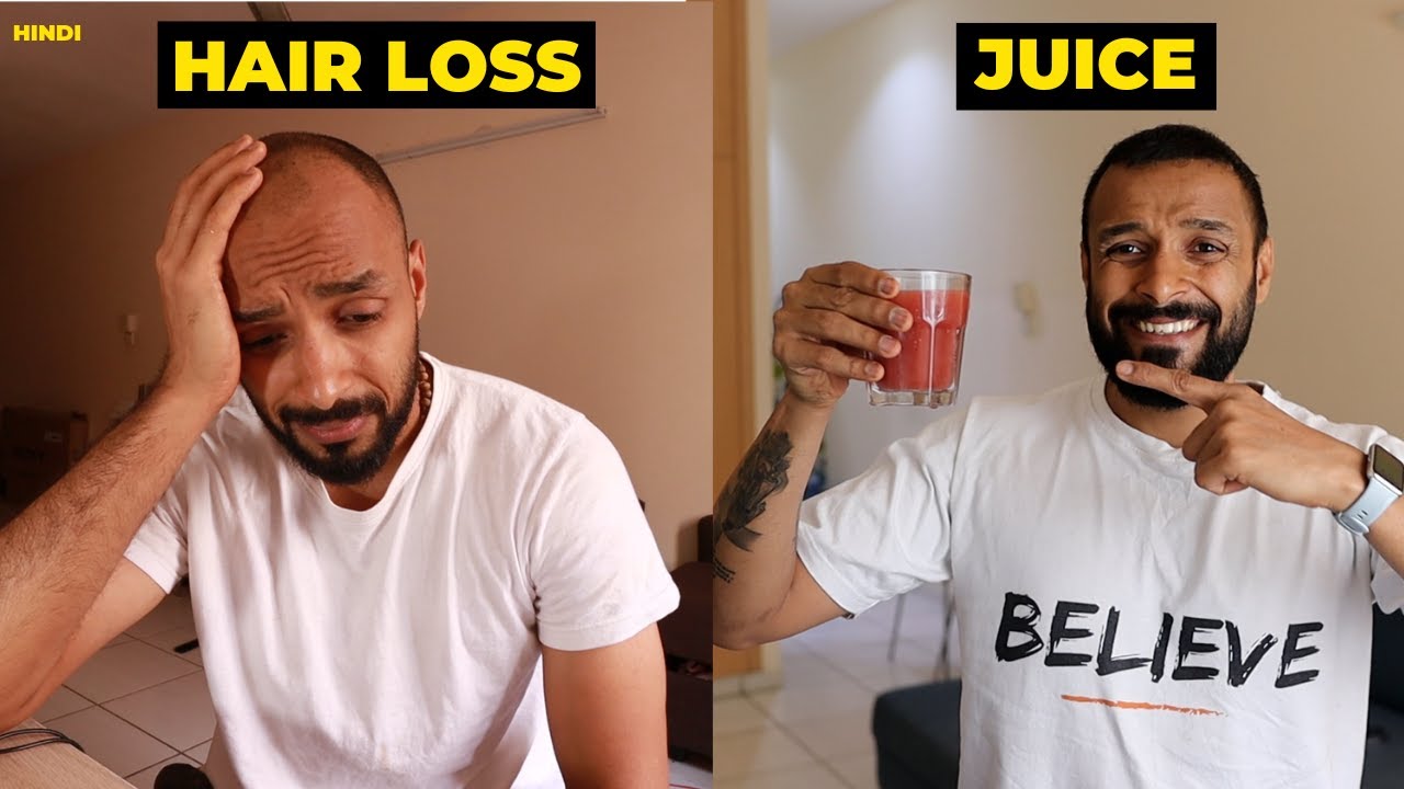 Prevent Hair Loss & Testosterone Boosting Juice 👨‍🦲✅