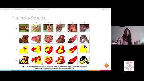 A Superpixel-wise Fully Convolutional Neural Network for Diabetic Foot Ulcer Tissue Classification
