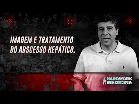 IMAGEM E TRATAMENTO DO ABSCESSO HEPÁTICO l HARDWORK MEDICINA