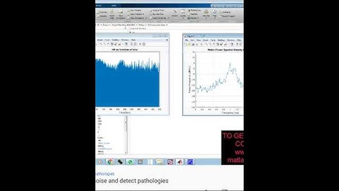 An ECG signal, remove noise and detect pathologies