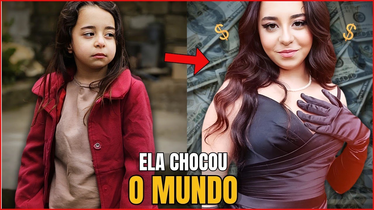 A verdade por trás da transformação de Beren que ninguém conta