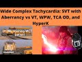 Wide Complex Tachycardia: SVT with Aberrancy vs VT, WPW, TCA OD, and Hyperkalemia ECG Interpretation