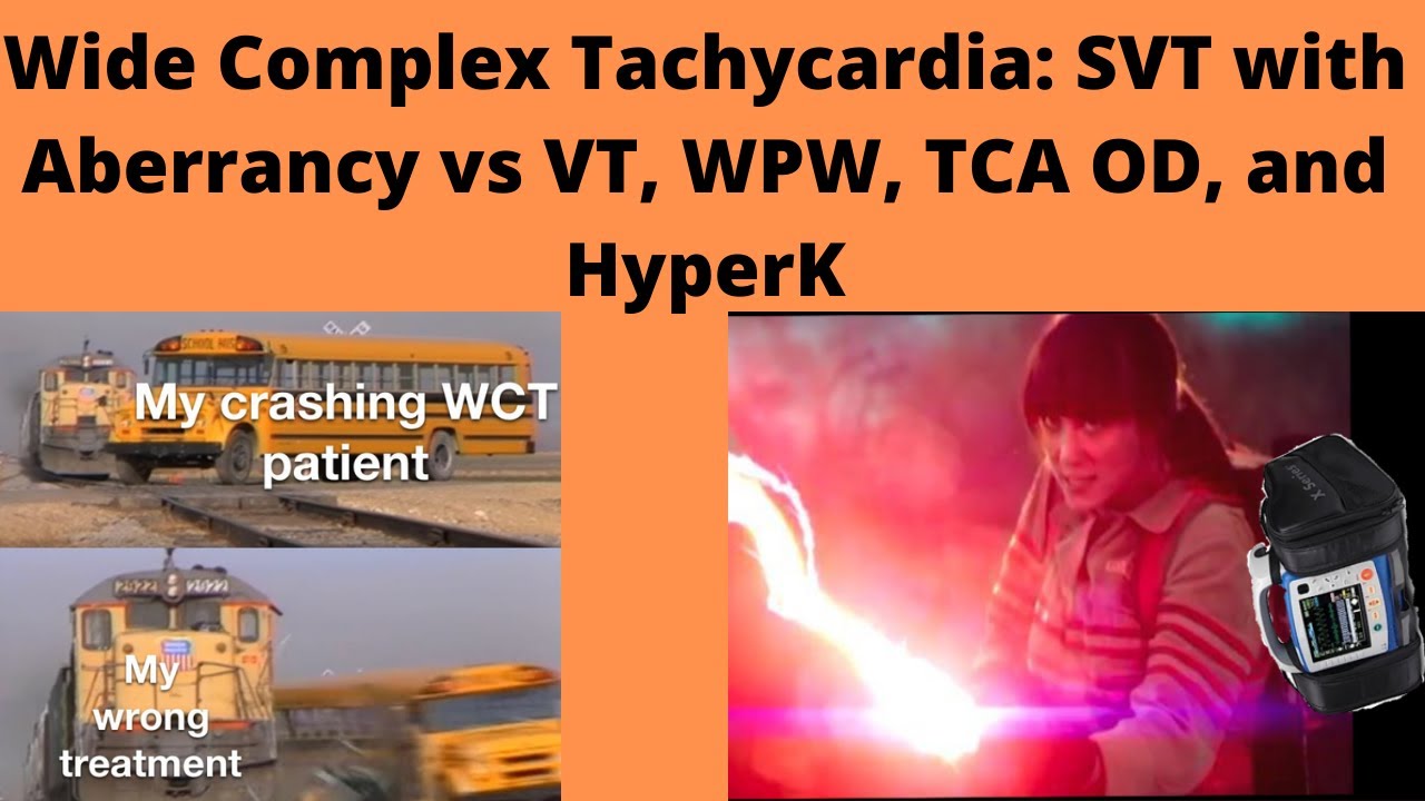 Wide Complex Tachycardia: SVT with Aberrancy vs VT, WPW, TCA OD, and Hyperkalemia ECG Interpretation