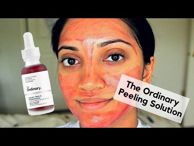 The Ordinary AHA 30% + BHA 2% Peeling Solution Review & Demo