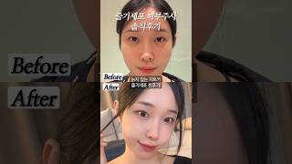 줄기세포 피부주사 찐후기! VVIP 들이 주기적으로 맞는 시크릿주사 보여드릴게요