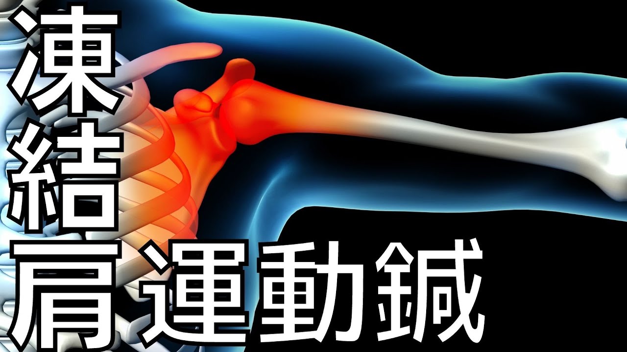 凍結肩（五十肩）の運動鍼