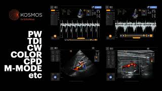 Full Kosmos POCUS Capabilities on Apple iOS screenshot 2
